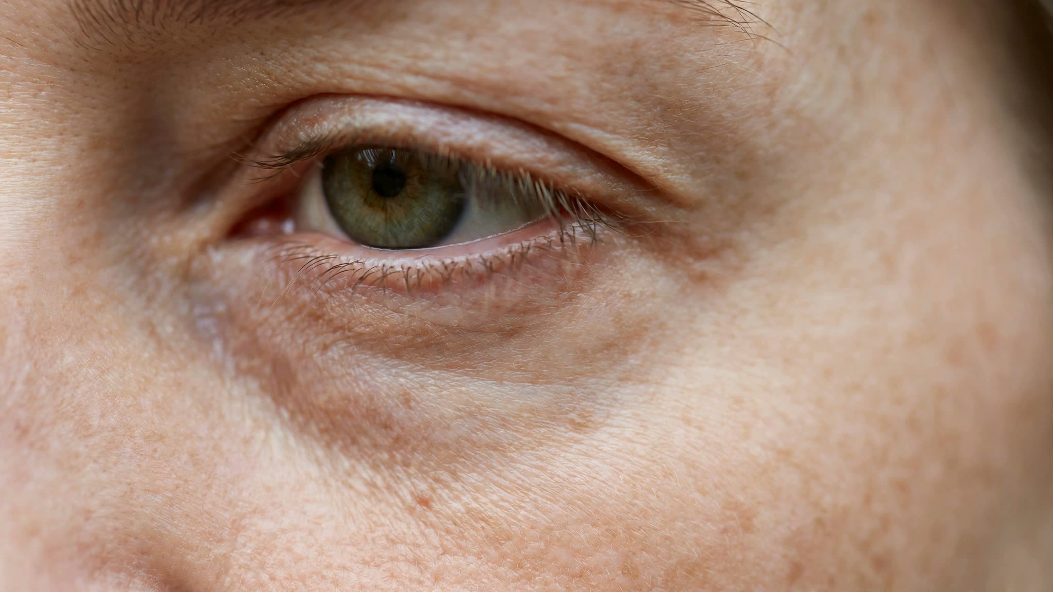 Why Is My Eye Twitching? Causes and How to Stop It
