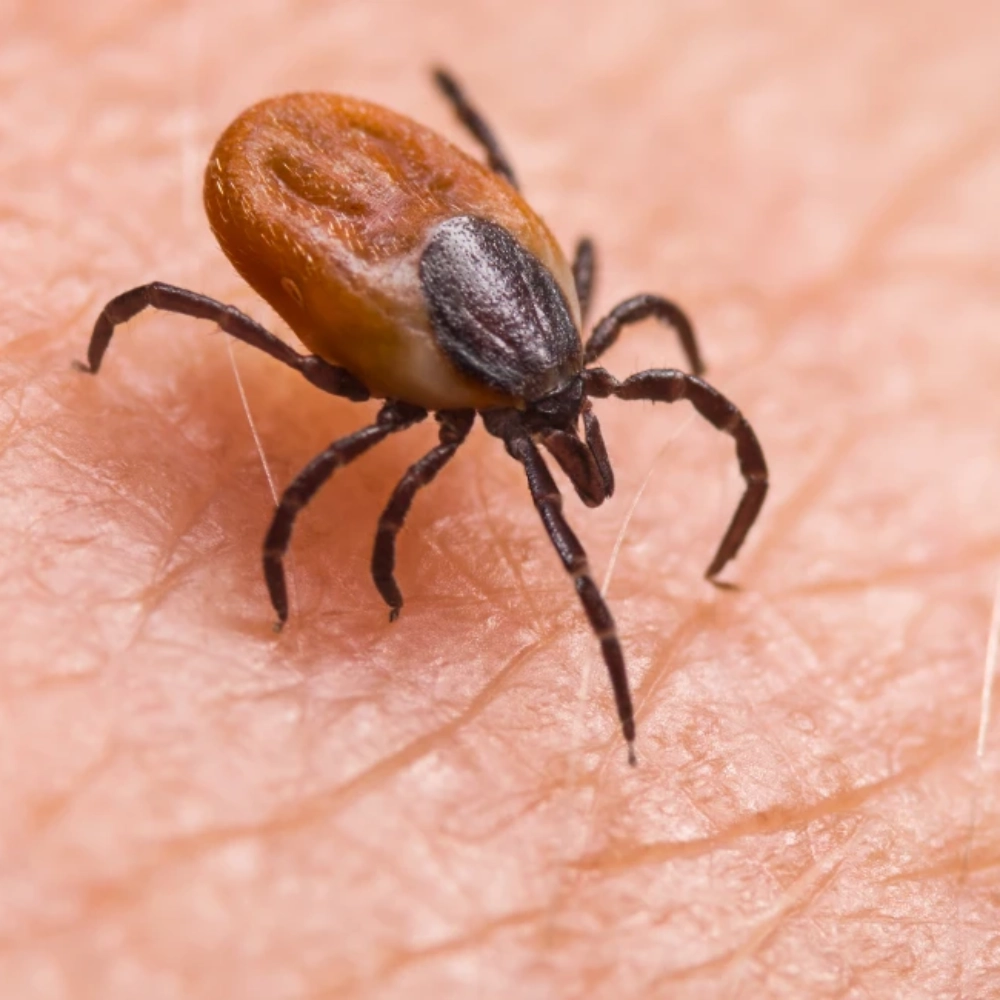 Lyme Disease Signs Most People Miss (Not Just the Rash)
